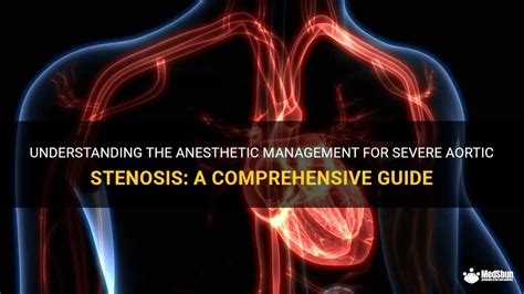 Understanding The Anesthetic Management For Severe Aortic Stenosis A