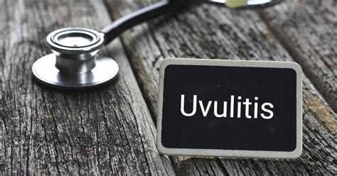 Uvulitis: A Swollen Uvula - Facty Health