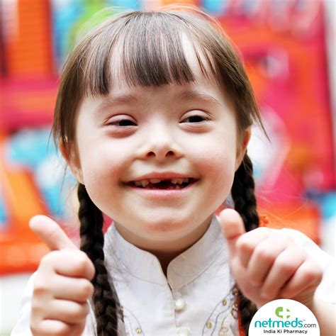 Down Syndrome Causes Symptoms And Treatment