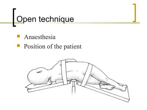 Puj Obstruction Ppt