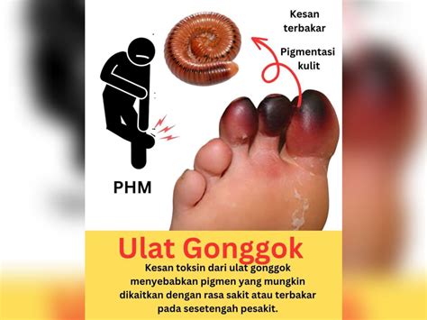 Ulat Gonggok Boleh Sebabkan Kulit Rengsa Kosmo Digital