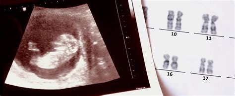 X Y Sex And Gender When Genetics Pulls A Fast One Genetic Literacy Project