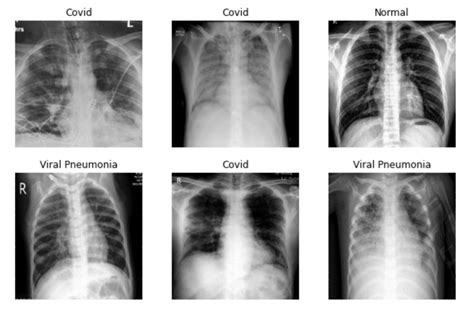 Sample Covid-19 CT scan dataset 1, 8 images | Download Scientific Diagram