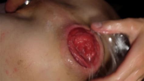 ティーンがこぶしをした後の非常識な腹の膨らみと巨大なローズバッド Pornhub Gay