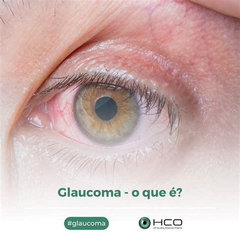 Glaucoma O Que Hco Uberl Ndia