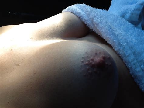 Hard Nipples Porn Pictures XXX Photos Sex Images PICTOA