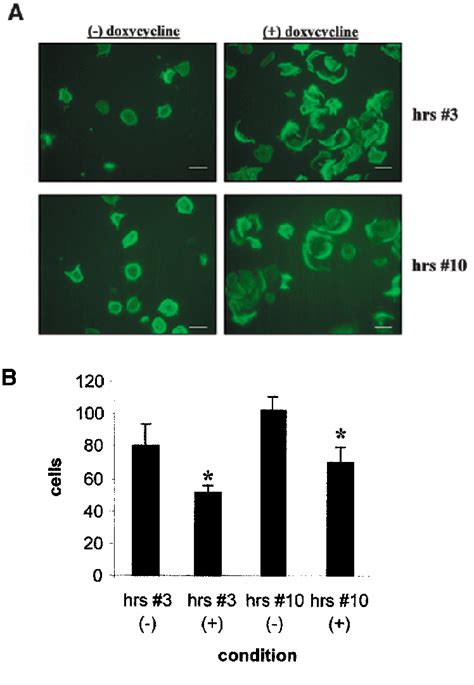 Regulated HRS Overexpression Impairs Cell Spreading And Motility In RT4