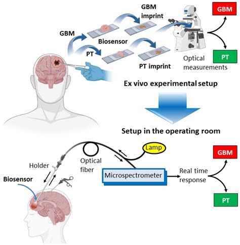 Discriminating Glioblastoma From Peritumoral Tissue By A Nanohole Array