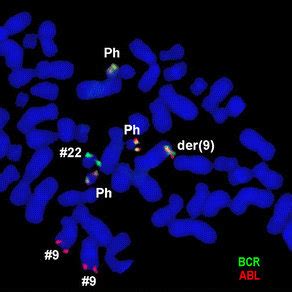 Gtg Banding Revealed A Hyperdiploid Karyotype All Derivative