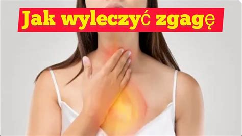 Jak Naturalnie Wyleczy Zgag Youtube