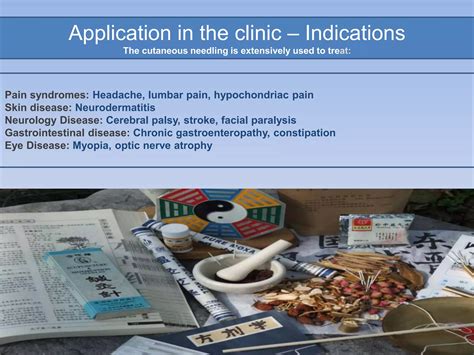 Three Edged Cutaneous Intradermal Needle Therapy Ppt