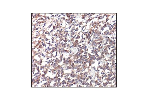 αβ Tubulin Antibody Cell Signaling Technology