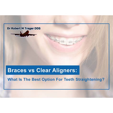 Braces Vs Clear Aligners Options For Teeth Straightening