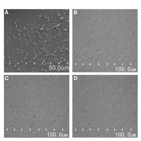 A The Morphological Observation Of Caco Cells By Scanning Electron