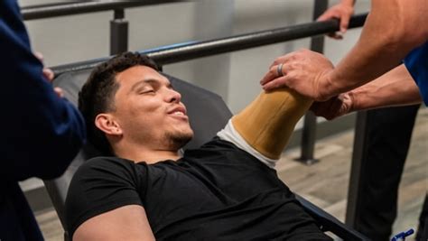 prosthetic arms attached   body pongratz orthotics