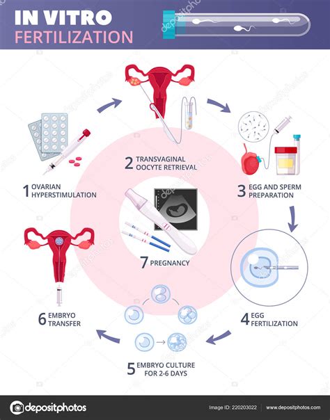 Na Fertilização In Vitro Enem - Diagrama De Fertilizacao In Vitro Clínica Fertilizar