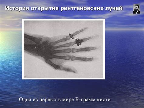 Введение в рентгенологию. Лекция №1 - презентация онлайн