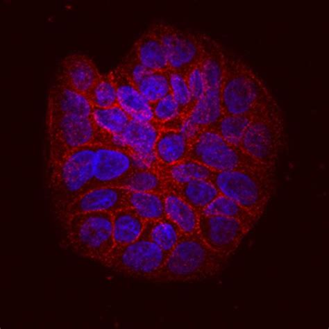 ITGB6 Antibody (MA5-24161)