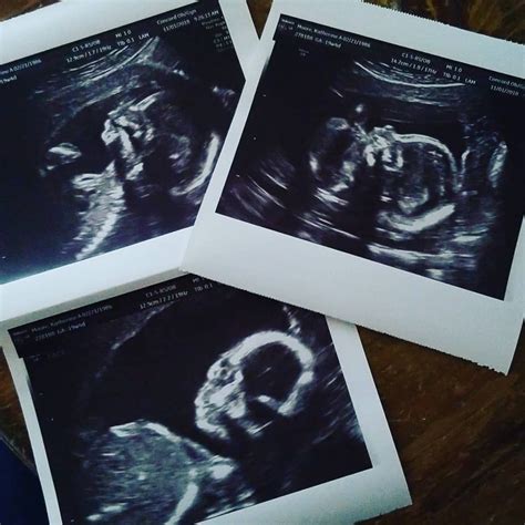 Gender Predictor How To Tell Your Baby S Sex At The Week Scan Artofit