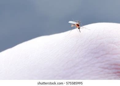 Mosquito Bites Human Skin Evening Stock Photo (Edit Now) 686325376