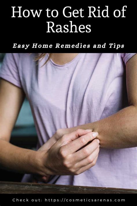 How To Get Rid Of Rashes Easy Home Remedies And Tips Home Remedies For Rashes How To Get Rid