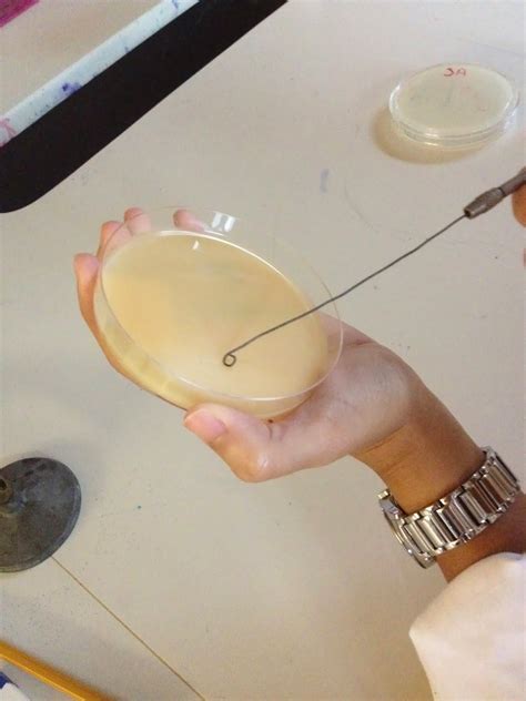 Rose And Lindseys Medical Microbiology Blog Casein Hydrolysis Test