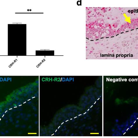 Pdf Stress And Nasal Allergy Corticotropin Releasing Hormone