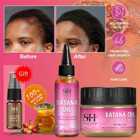 100 Pure Batana Growth Oil Set For Traction Alopecia Butter Hair Mask