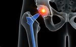 Inzest Ist Sex Unter Geschwistern Bald Erlaubt