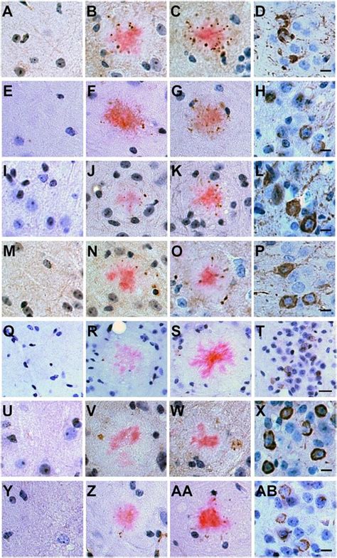 Phospho Tau Ser202 Thr205 Monoclonal Antibody At8 Biotin Mn1020b