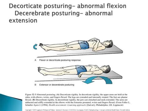 Ppt Altered Cerebral Function And Increased Intracranial Pressure