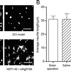 The Effects Of Nep And Singr On Neurite Outgrowth In The Six Groups