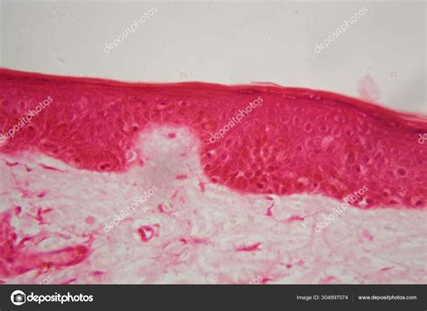 detail  skin   microscope stock photo  chweiss