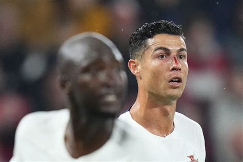 Daftar Pemain Top Yang Terkena Virus Fifa Cristiano Ronaldo Berdarah