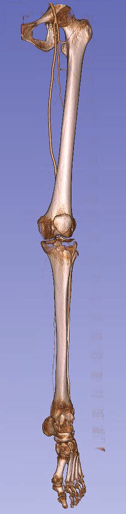 Nice Leg Dataset Could Be Used For Atlas Openanatomy D Slicer