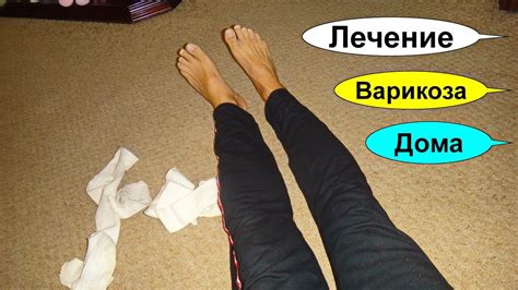 Вены на ногах. Лечение варикоза. Закупорка сосудов. Тромбы. Целебный ...