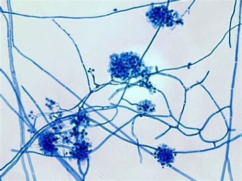 Fun With Microbiology (What's Buggin' You?): Beauveria species