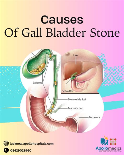 Female Gall Bladder Symptoms What You Need To Know By Apollomedics Super Specialty Hospital