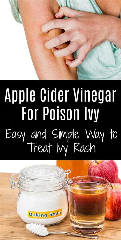 Apple Cider Vinegar For Poison Ivy Easy And Simple Way To Treat Ivy Rash Apple Cider