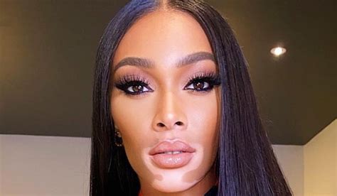 Winnie Harlow - Bio, Age, Height, Wiki All Models Bio