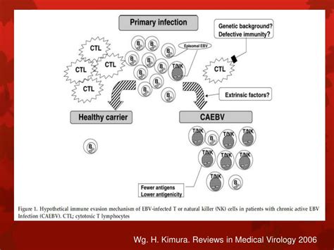 PPT Zakażenie EBV PowerPoint Presentation free download ID 3290786