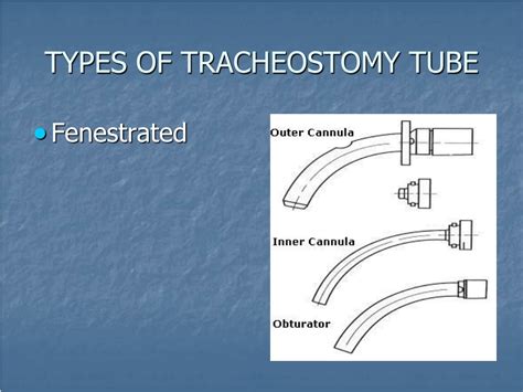 Tracheostomy Vs G Tube at Joyce Collins blog