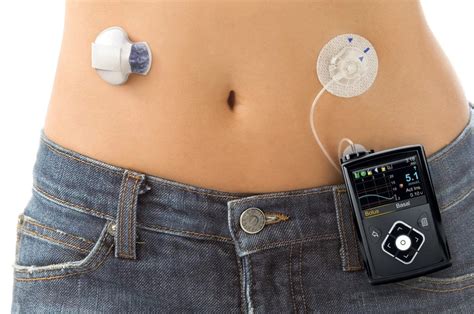 This FDA approved new device might actually revolutionize diabetics care
