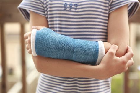 How Casts Work To Heal A Broken Bone