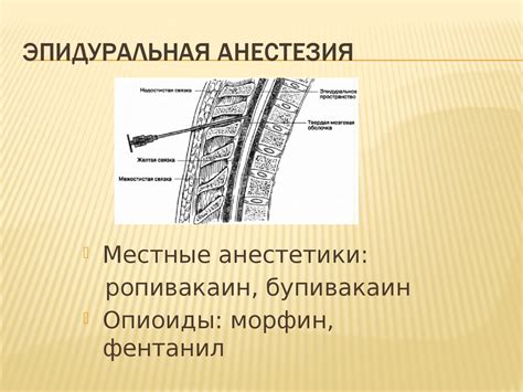 Регионарная анестезия - презентация онлайн
