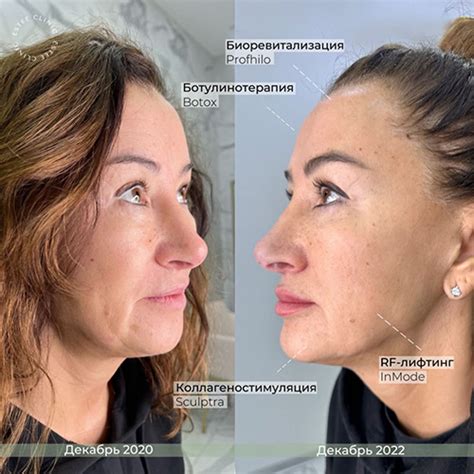 Estee Clinic | Клиника эстетической медицины