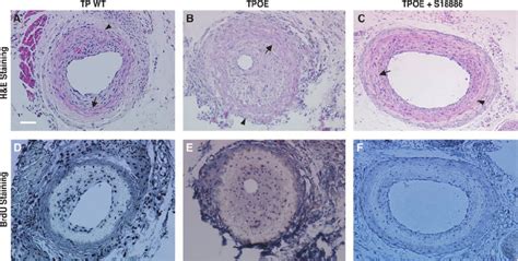 Morphometric Analysis Of Carotid Ar Teries And Tx M Bio Synthesis