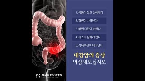 대장암2기 항암 및 방사선 치료 후의 중요성 네이버 블로그