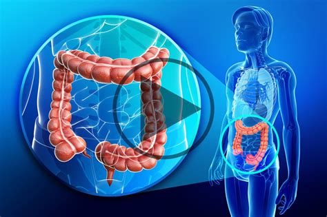 Management Of BRAF Mutant Metastatic Colorectal Cancer Oncology