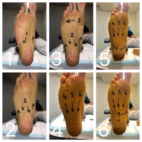Revolutionize Your Foot Pain Relief With Strapping Plantar Fascia The Ultimate Guide